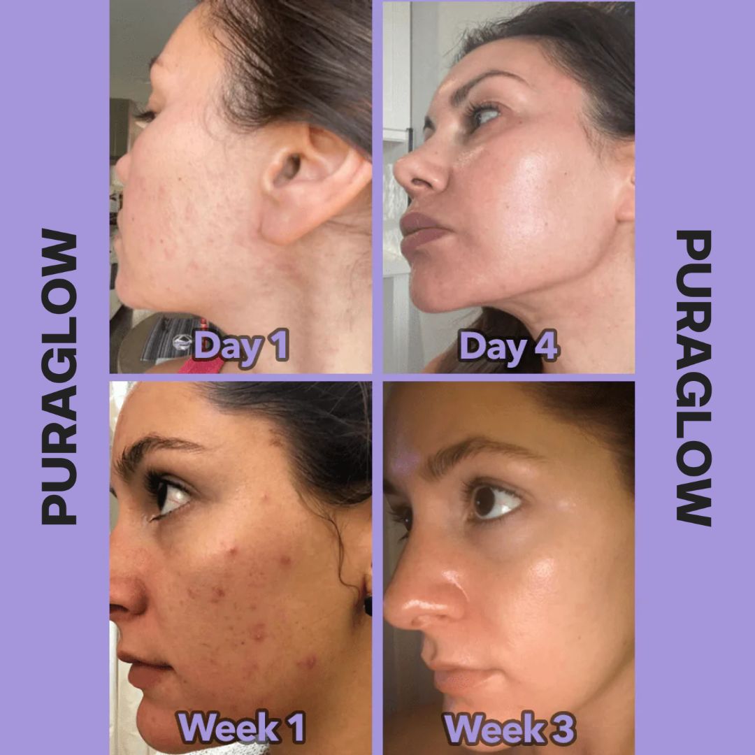 PuraWand Radiant Skincare
